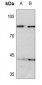 Anti-KIF2C (pS95) Antibody
