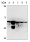 Anti-Cytokeratin 8 (pS432) Antibody