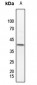 Anti-MKK3 (pT222) Antibody