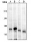 Anti-ASK1 (pS83) Antibody