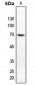 Anti-TAK1 (pT184) Antibody