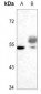 Anti-TAU (pS721) Antibody
