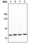 Anti-MARK2 Antibody