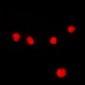 Anti-MEF2A (pT312) Antibody