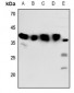 Anti-Melatonin Receptor 1b Antibody