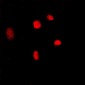 Anti-MYBL2 Antibody