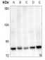 Anti-MYBL2 Antibody