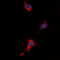 Anti-P2Y4 Antibody