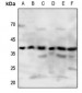 Anti-P2Y4 Antibody