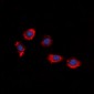 Anti-P2Y8 Antibody