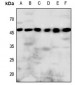 Anti-P2Y8 Antibody