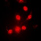 Anti-Progesterone Receptor (pS190) Antibody