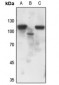 Anti-Progesterone Receptor (pS190) Antibody