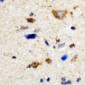 Anti-MYT1 Antibody