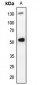 Anti-PLK1 Antibody