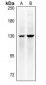 Anti-MYPT1 (pT853) Antibody