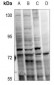 Anti-PKC alpha (pT638) Antibody