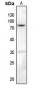 Anti-PKC beta (pS661) Antibody