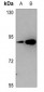 Anti-PKC epsilon (pS729) Antibody