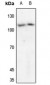 Anti-PKC mu Antibody