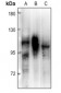 Anti-PRKD2 Antibody