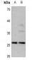 Anti-CD201 Antibody