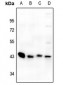 Anti-GPR73a Antibody