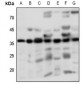 Anti-PGD2 Receptor Antibody