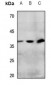 Anti-IP Receptor Antibody