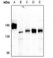 Anti-PTP alpha Antibody