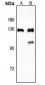 Anti-CTIP Antibody