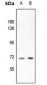 Anti-S6K1 (pT412) Antibody
