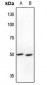 Anti-S6K2 Antibody