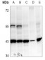 Anti-PEDF Antibody