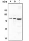 Anti-SKIL Antibody