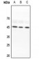 Anti-Lupus La Antibody