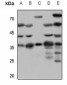 Anti-SSTR1 Antibody