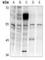 Anti-LKB1 (pT189) Antibody