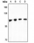 Anti-TAO1 Antibody