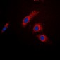 Anti-AS160 Antibody