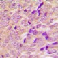 Anti-AS160 Antibody