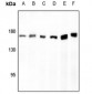 Anti-AS160 Antibody