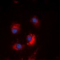 Anti-TCF6 Antibody