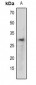 Anti-TCF6 Antibody