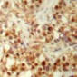 Anti-p53 (pS6) Antibody