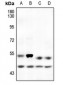 Anti-p53 (pS6) Antibody