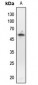 Anti-p53 (pT18) Antibody