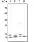 Anti-TRAPPC3 Antibody