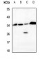 Anti-VTI1B Antibody