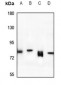 Anti-Rabenosyn 5 Antibody